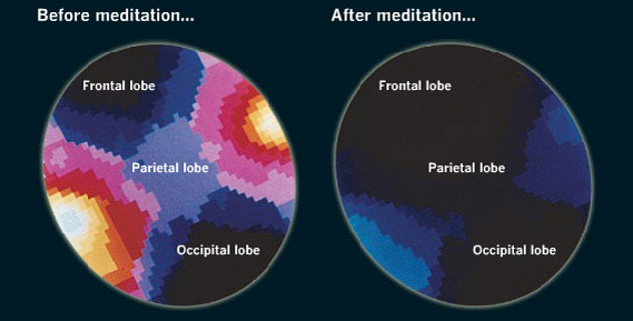 Meditate to Improve Memory